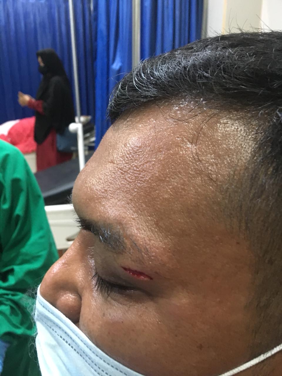 Oknum Perwira Polisi Polda Bengkulu Diduga Keroyok Warga di Polsek Gading Cempaka